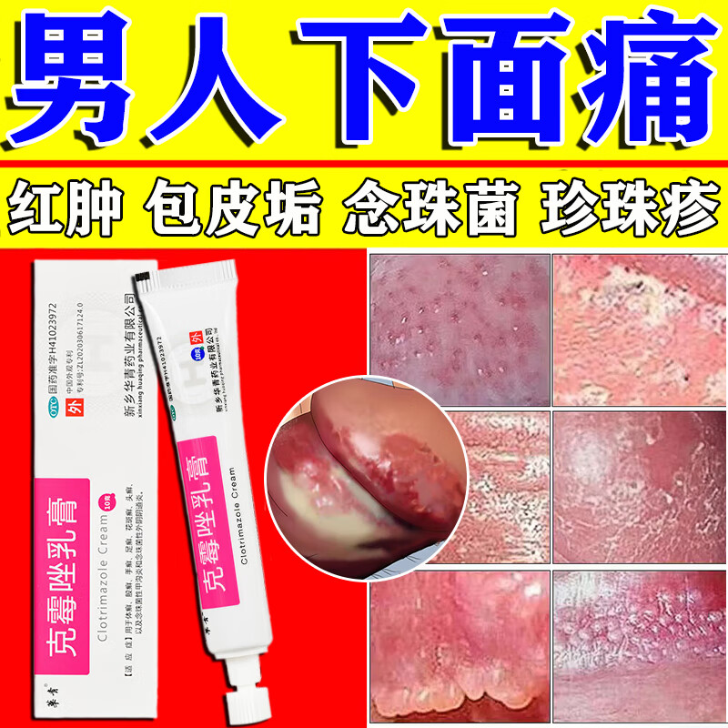 克霉唑软膏 龟头炎专用药膏包皮炎 红点 念珠菌 霉菌专用药 男性私处