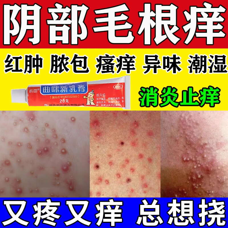 阴部毛囊炎药专用药膏】男性女性阴部毛下瘙痒真菌感染私处红肿有异味