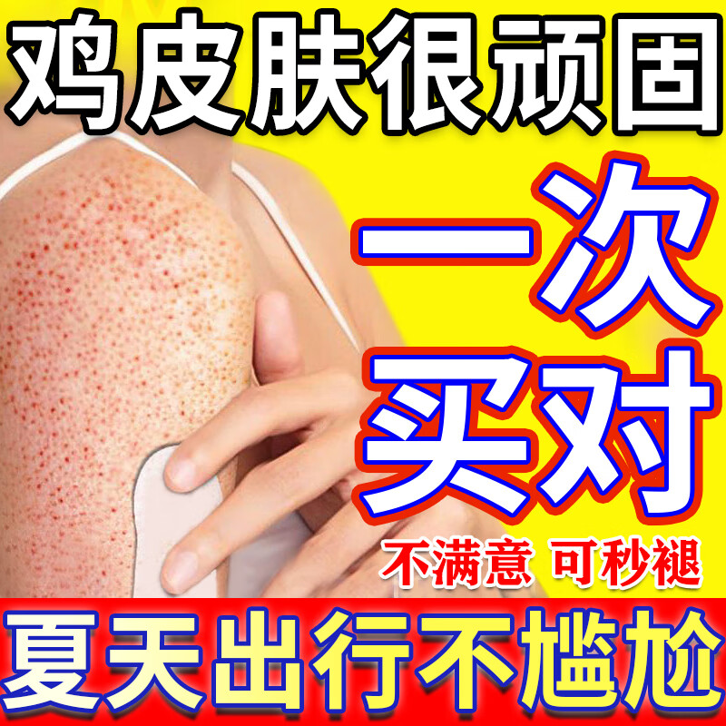 鸡皮肤疙瘩毛囊角化症专用非去除膏非药品非去鸡皮肤毛囊角质疙瘩大腿