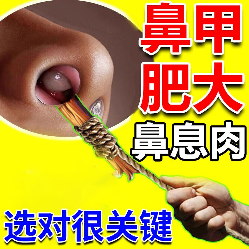 鼻甲肥大鼻息肉专用喷剂鼻塞神器鼻腔黏膜充血过敏性鼻窦炎成人儿童