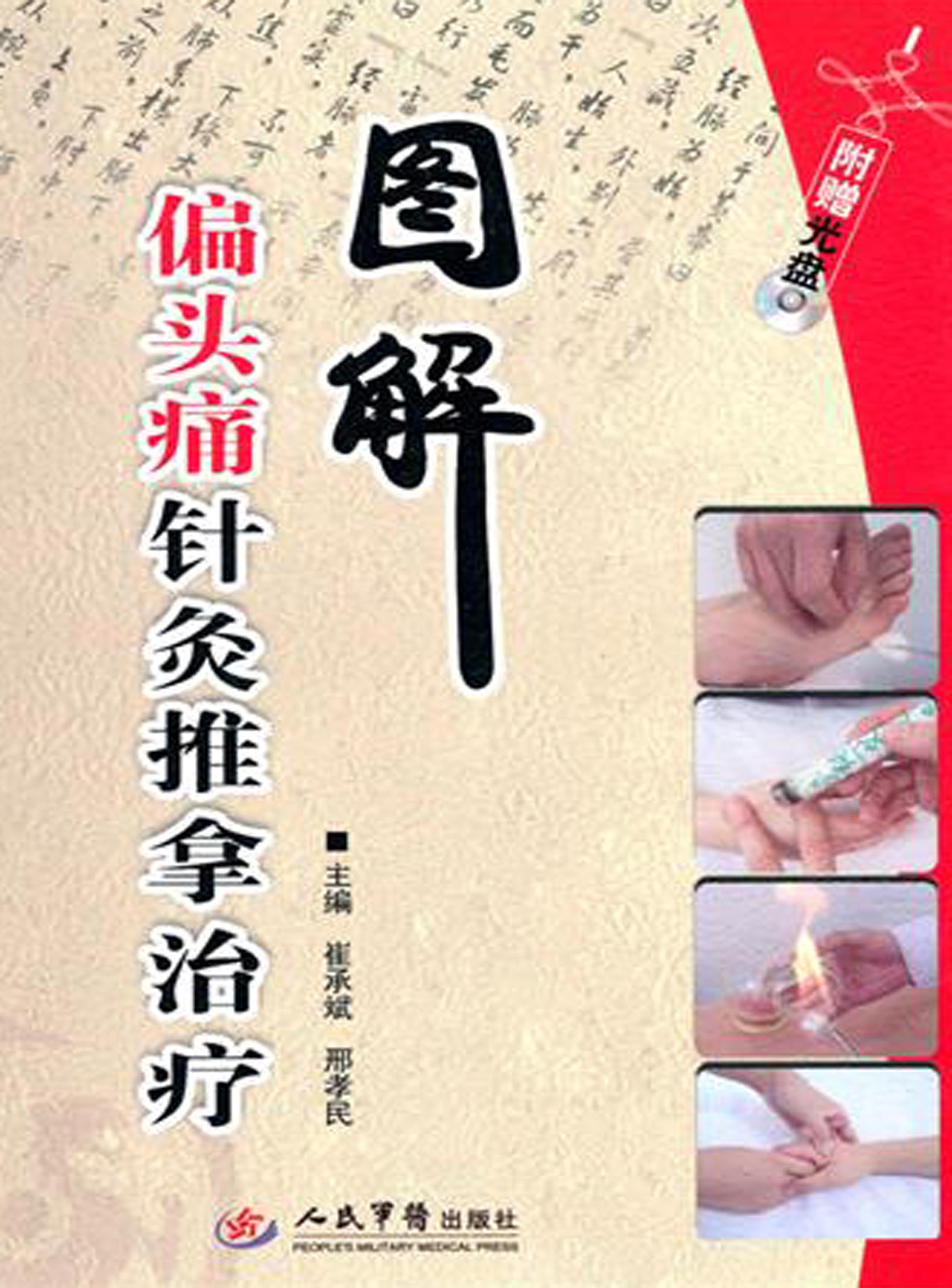 图解偏头痛针灸推拿治疗