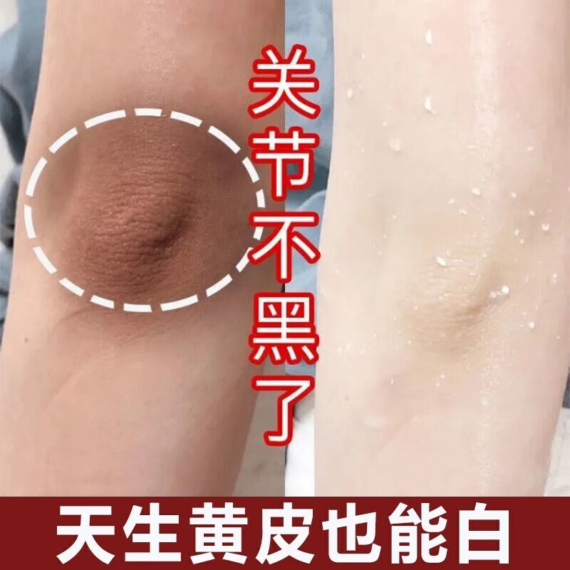 关节去i黑膝盖手指全身去角质胳膊肘腋下手肘变白黑脖子腋窝身体 一
