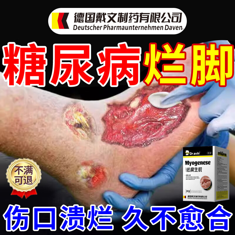 代文医用糖尿病烂足生肌膏伤口愈合专用膏药褥疮老烂脚发炎流脓去腐m9