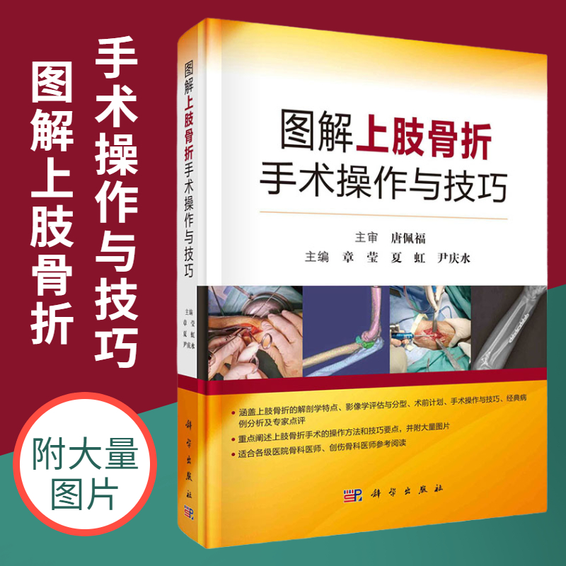 图解上肢骨折手术操作与技巧 章莹,夏虹,尹庆水 主编 科学出版社