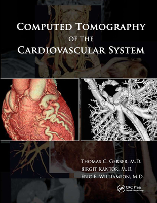 【预订】computed tomography of the