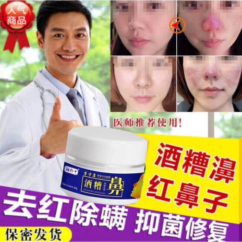 祖郎中酒糟鼻去红鼻子清除鼻头红血丝螨虫黑头脩复红鼻子鼻子疼 单