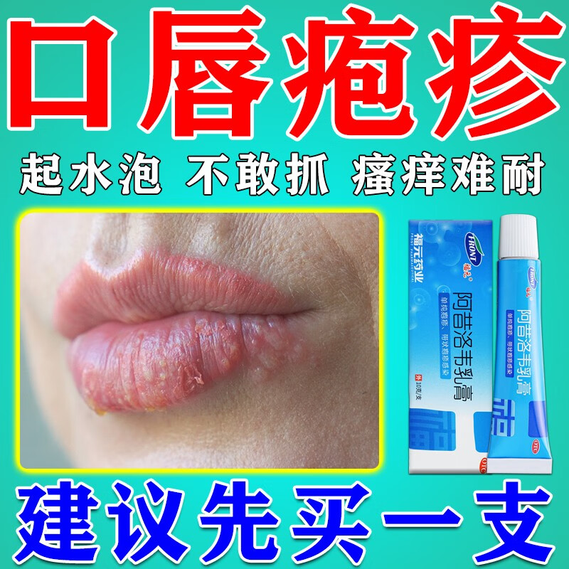 嘴唇疱疹起泡烂嘴角起水泡嘴巴脓疮上火嘴角疱疹上火口角炎烂嘴角药膏