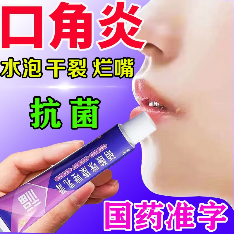 嘴角溃烂软膏口角炎】儿童成人通用治嘴巴上火嘴唇周起泡 嘴角疱疹
