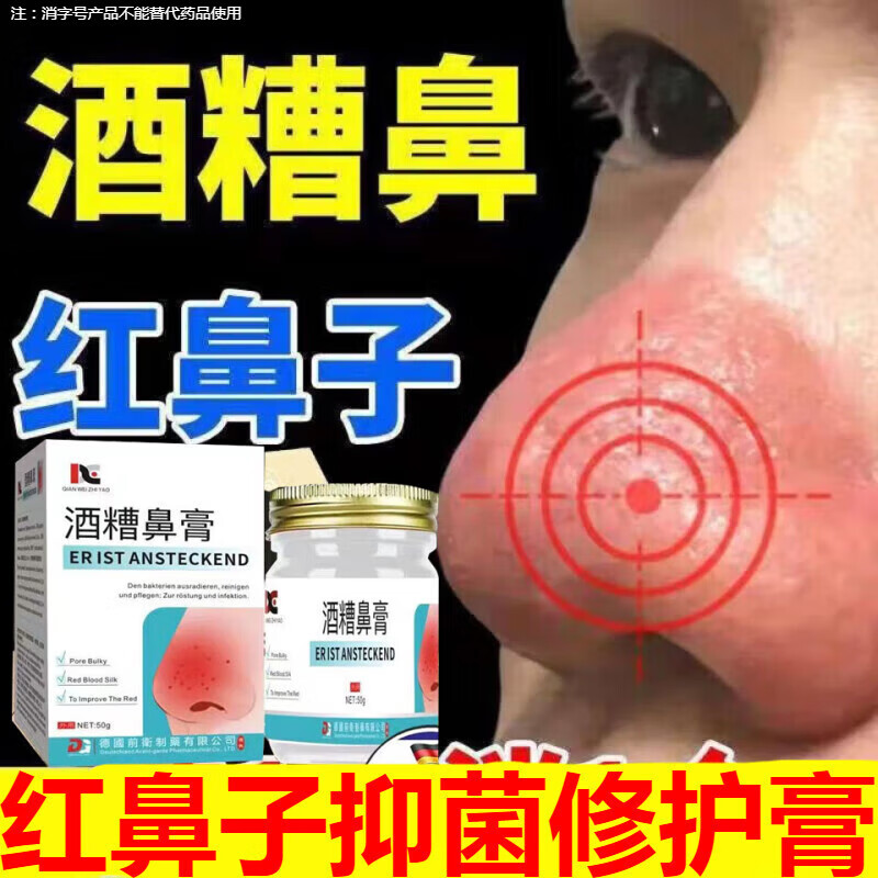黄人康德国红鼻子酒糟鼻抑菌膏鼻头红肿红血丝油腻痘痘脓包黑头螨虫