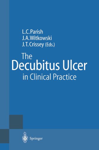 预订 the decubitus ulcer in clinical practice