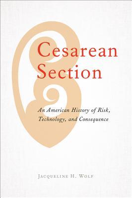 预订cesarean section: an american history of risk, t