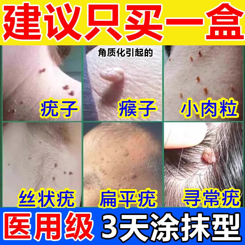 维a酸乳膏治扁平疣专用药膏面部脖子去用瘊子肉粒疙瘩除的小肉粒猴子