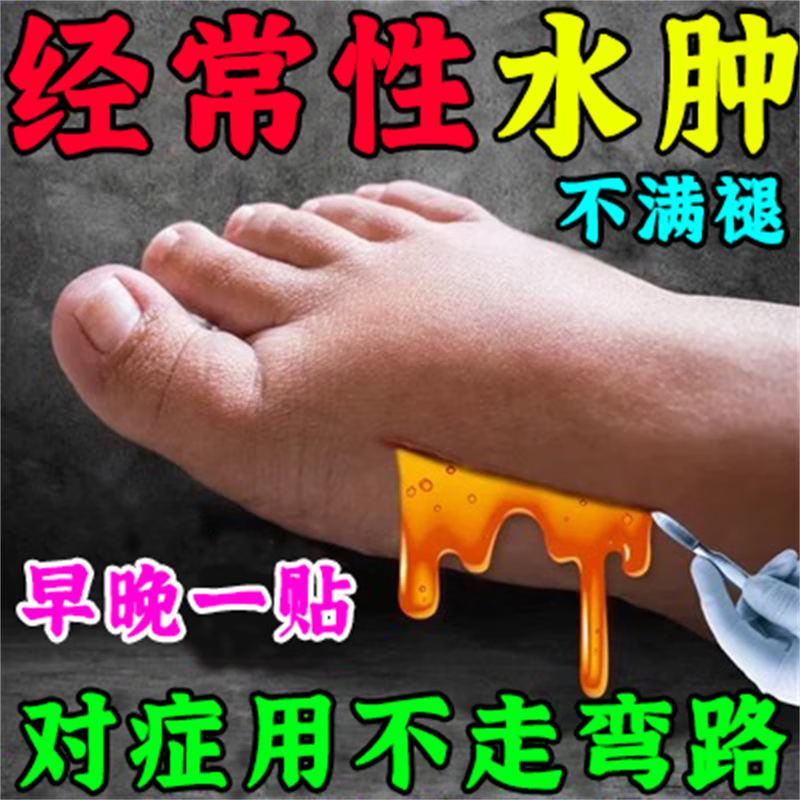 缓解水肿下肢浮肿去腿肿脚肿排水肿老人脚肿保健贴 单盒装