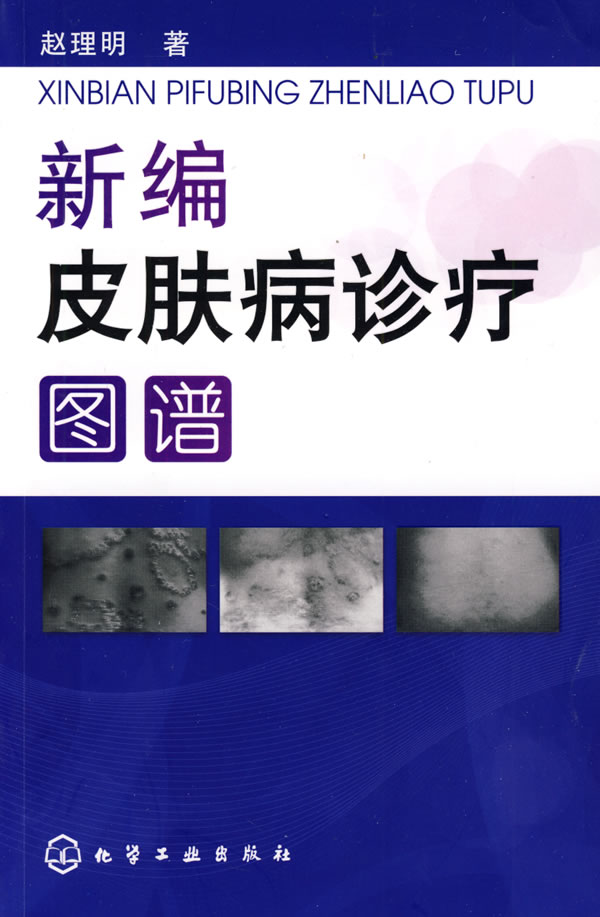 新编皮肤病诊疗图谱【正版特惠】