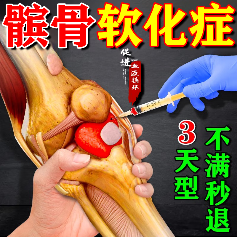 髌骨软化症专用膏药贴膏髌骨疼痛髌健炎贴膏髌健炎专用膏药贴髌骨关节