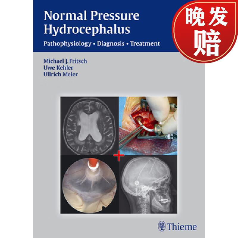 【4周达】nph - normal pressure hydrocephalus: pathophysiology
