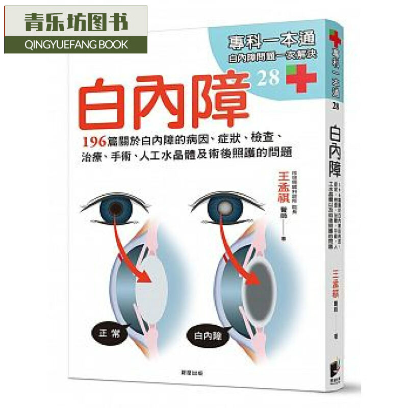 预售台版 白内障：196篇关于白内障的病因......以及术后照护的问题