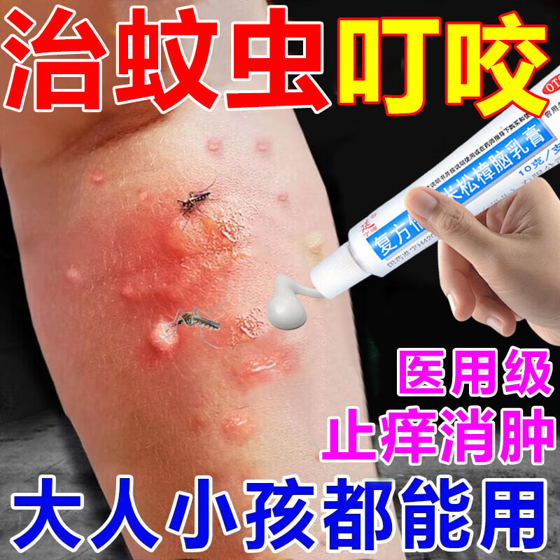 蚊虫叮咬止痒消肿药膏 止痒 抑菌 皮肤瘙痒跳蚤蚊子叮咬止痒消肿抑菌