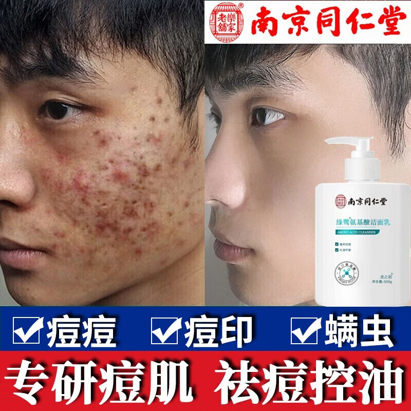 兰本诗南京同仁堂氨基酸洗面奶祛痘控油洁面乳男女士去黑头除螨洗面奶 1瓶装 500ml大容量更实惠