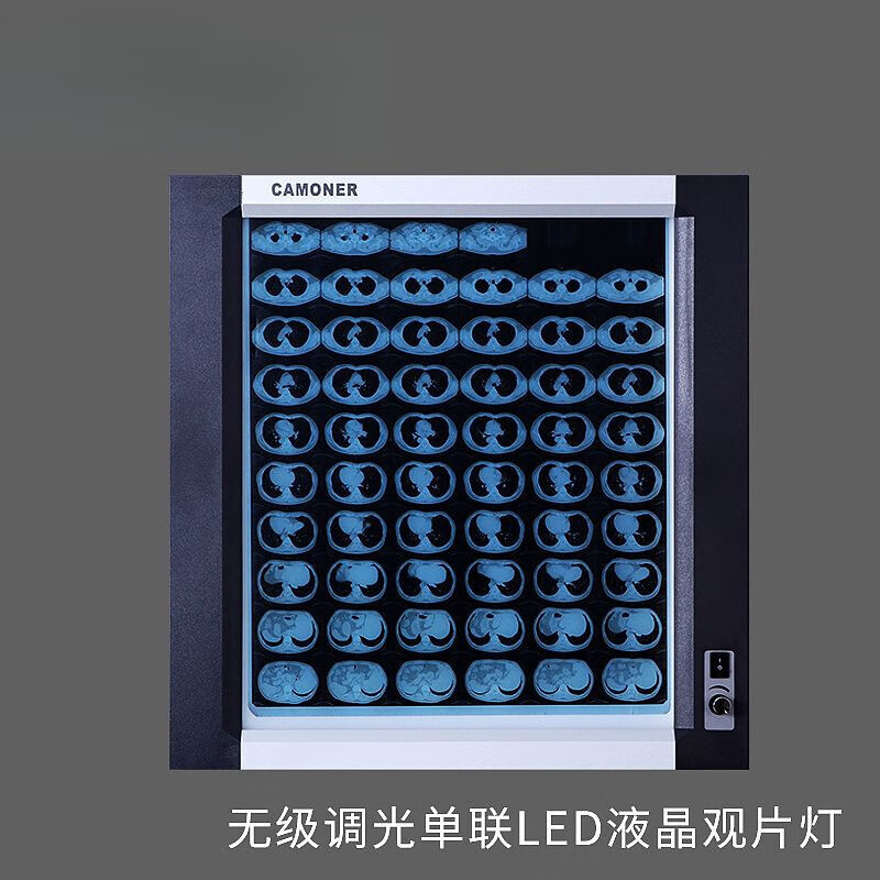 led观片灯医用阅片灯箱新款骨科读片灯观片器双联x光看片灯感应ct 单