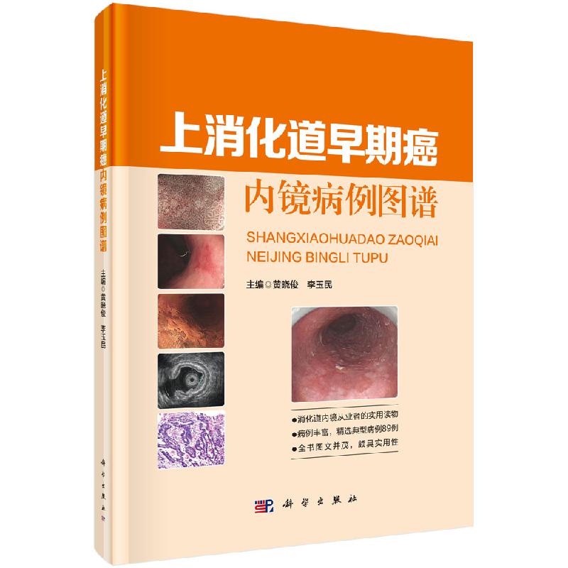 上消化道早期癌内镜病例图谱科学出版社