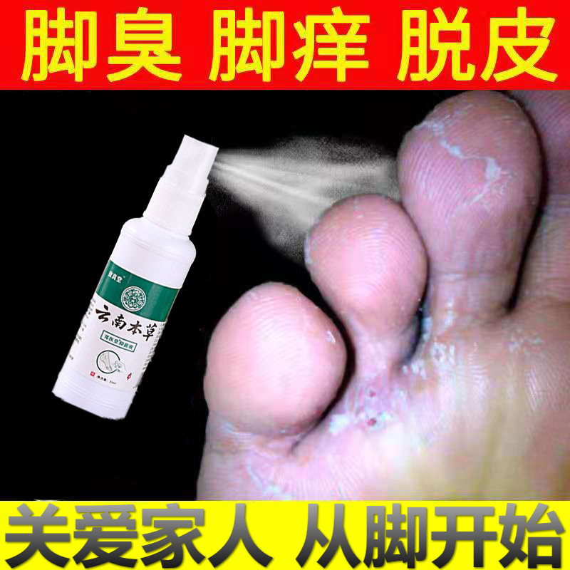 脚气喷剂脚痒脱皮脚丫癣祛脚香港l脚气脚丫烂水泡脚汗喷雾足顽癣足舒