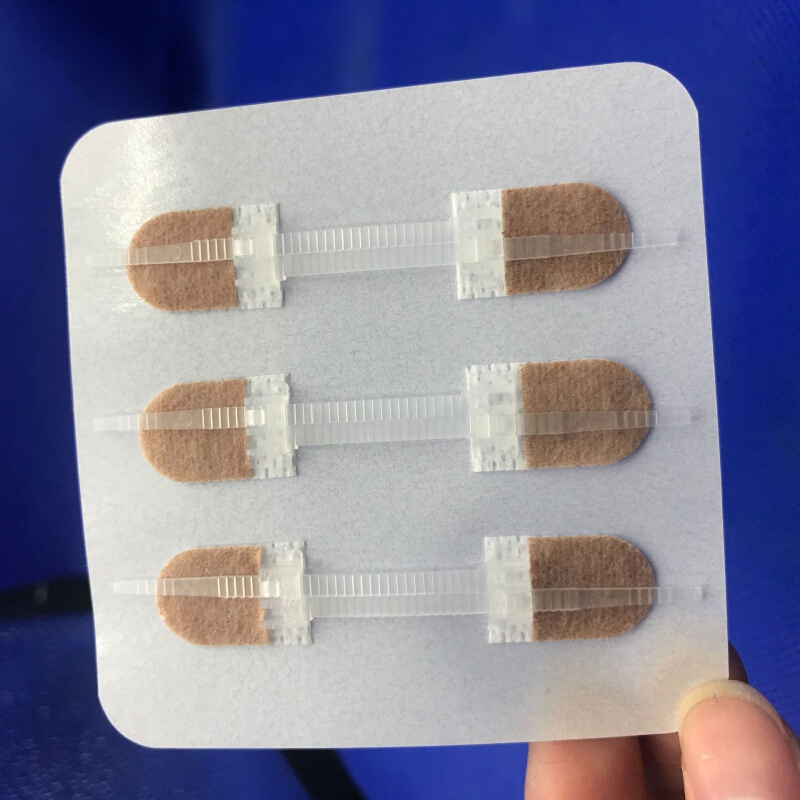 户外免缝胶带伤口快速缝合拉链式创可贴新型免缝针缝合贴 肤色 70*