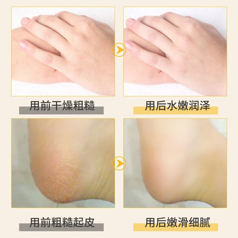 淑容(Sukyung)泰国原装进口带防伪香蕉膏脚后跟开裂手足干裂护脚霜滋润防裂男女 香蕉膏3瓶【带防伪】