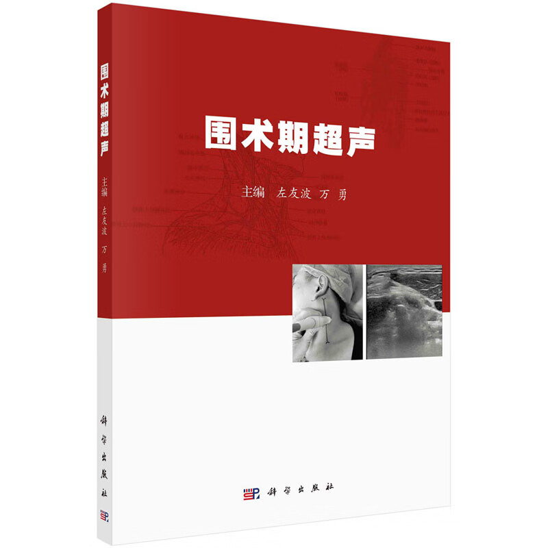 圍術期超聲 左友波 萬勇 圍術期超聲的基本理論和基本技術