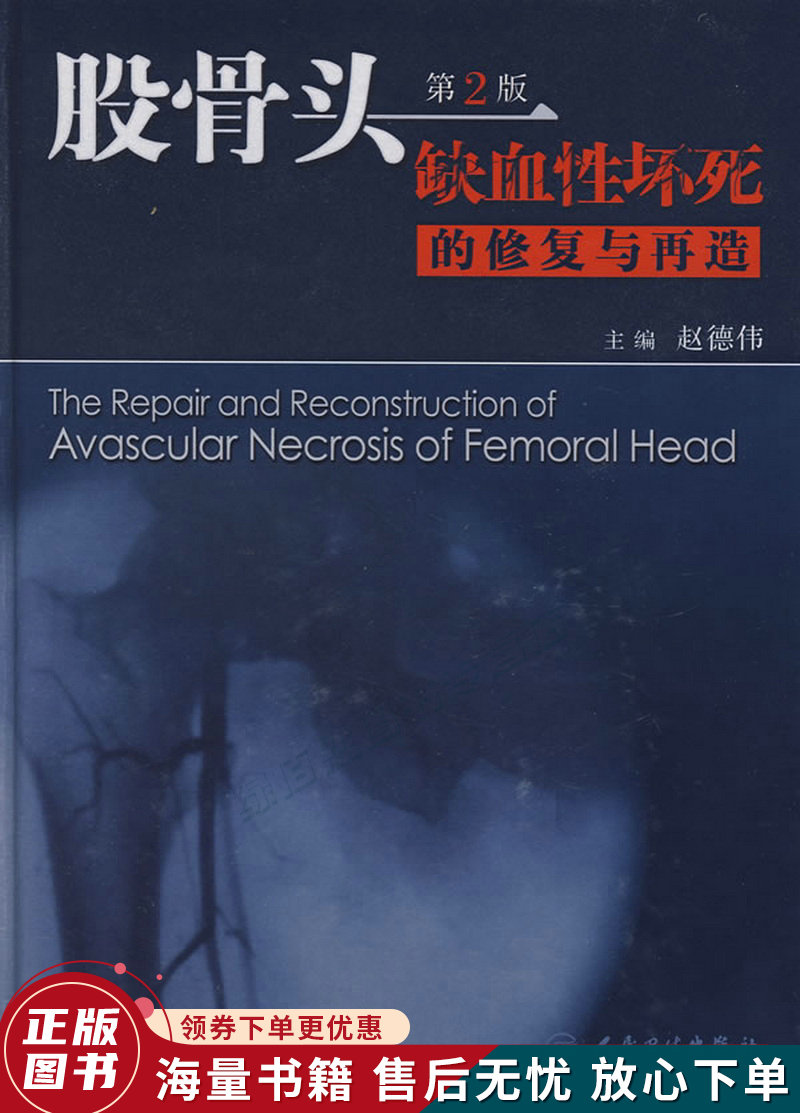 股骨头缺血性坏死的修复与再造第2版