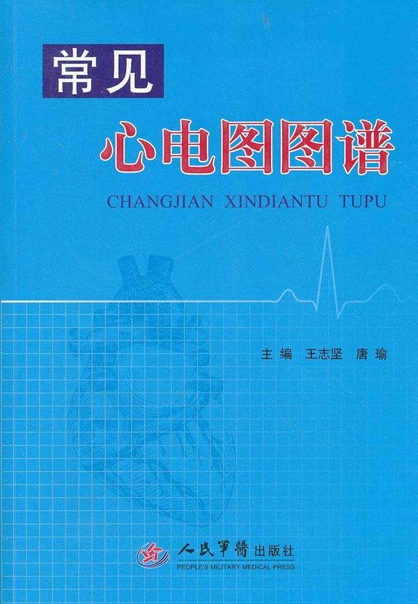 常见心电图图谱