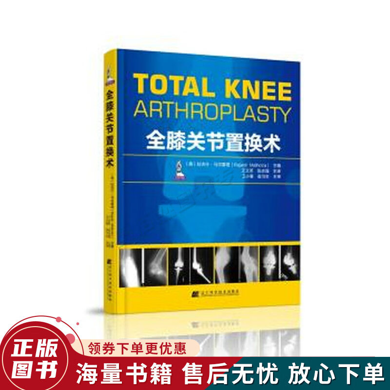 全膝关节置换术