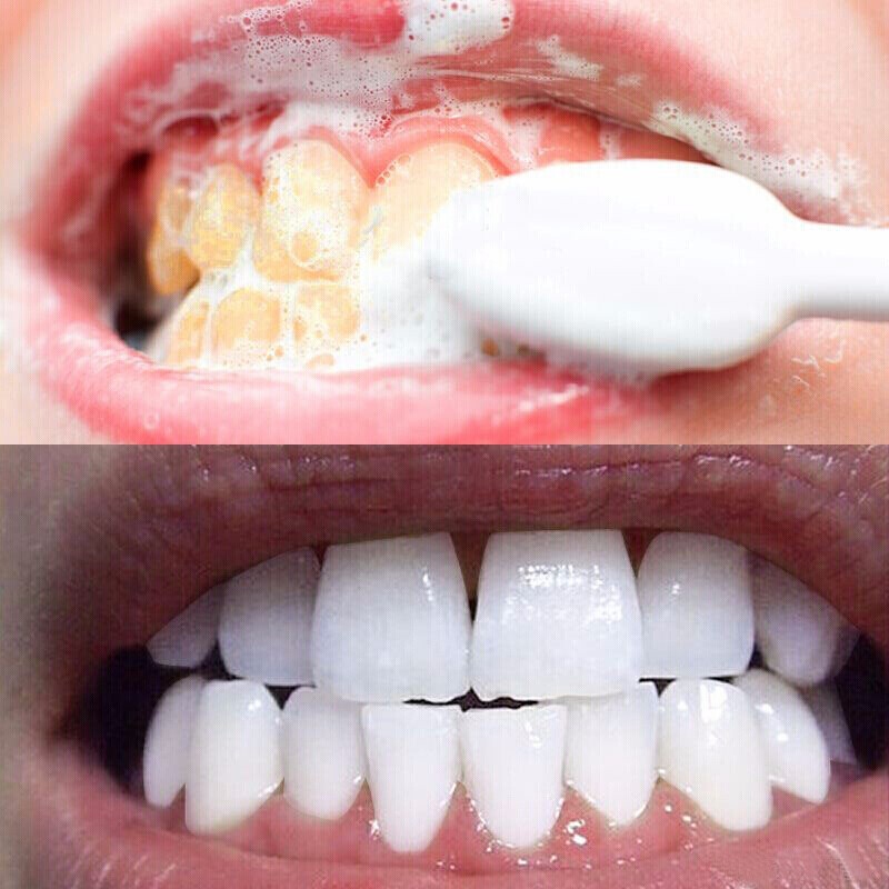 洗牙粉牙齿洁白洁牙粉去烟牙渍牙结石黑黄牙垢牙斑亮白牙素牙粉 珍珠美白牙粉 1盒