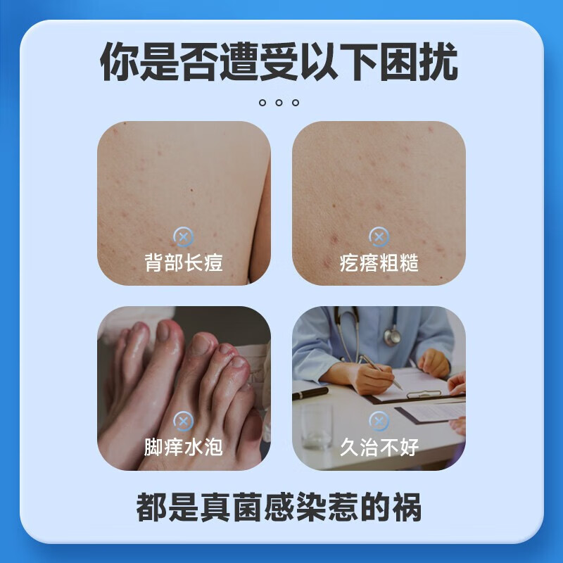 [仁和]联苯苄唑溶液 1%*70ml 1盒装 70ml/盒 脚气药止痒脱皮烂脚丫真菌感染止痒治脚气喷剂脚臭喷雾联苯卡唑癣症