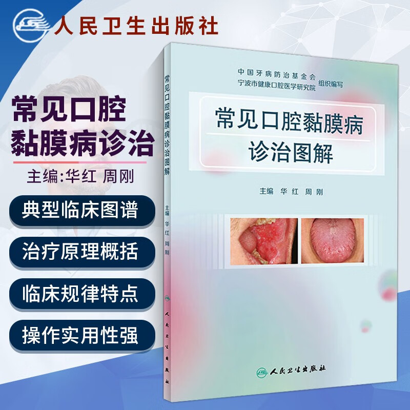 常见口腔黏膜病诊治图解 口腔溃疡类疾病的诊治基础 口腔黏膜病治疗