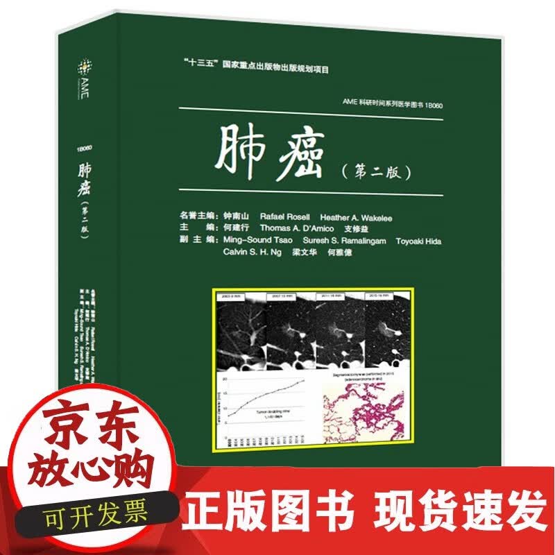 肺癌（第二版）正版