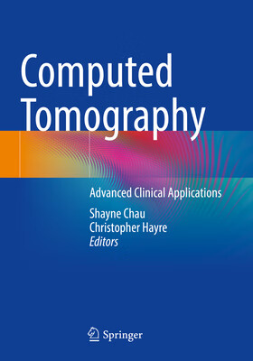预订  computed tomography