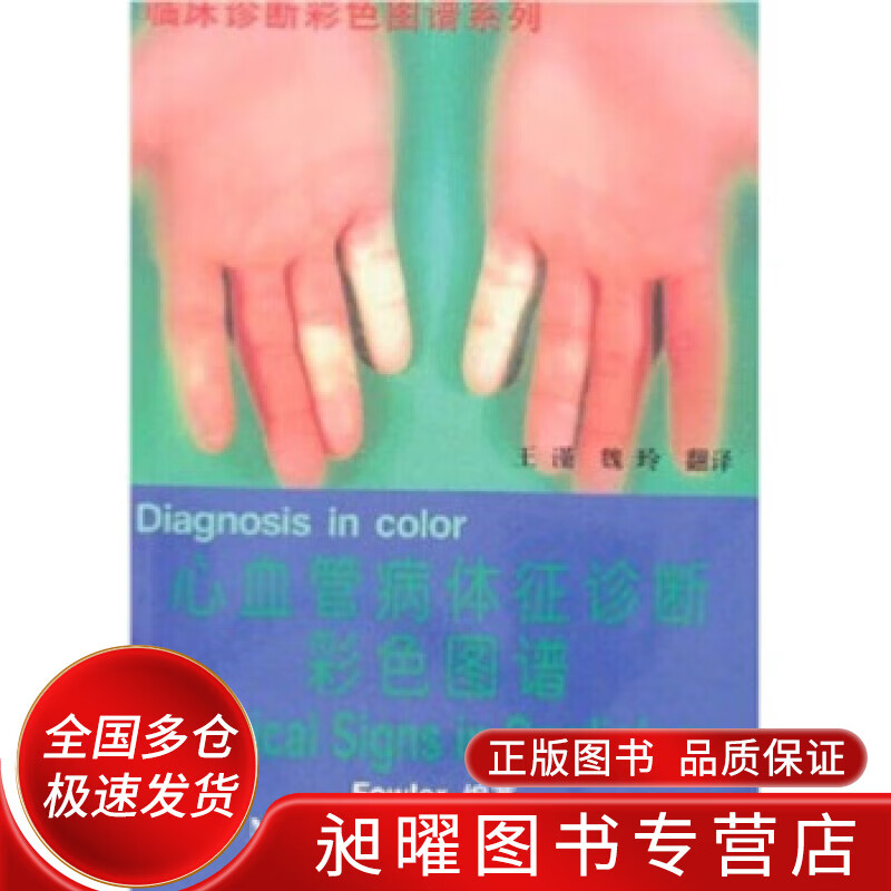 心血管病体征诊断彩色图谱【精选】