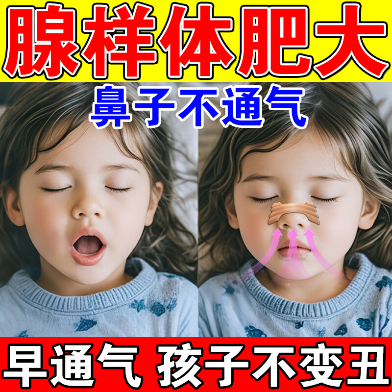 葵花通气鼻贴儿童腺样体肥大贴矫正张嘴呼吸鼻炎鼻甲肥大鼻堵塞不通气 3盒【疗程装】睡觉张嘴呼吸专用 京东折扣/优惠券