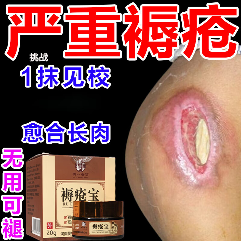 祥医堂解毒生肌膏长肉愈合伤口去祛腐生肌膏 褥疮溃烂老烂腿褥疮膏