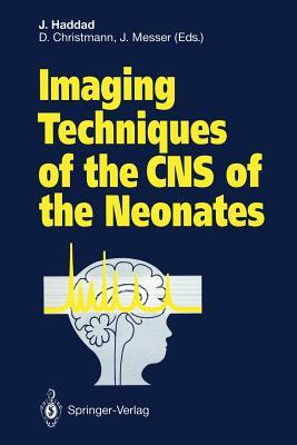 预订imaging techniques of the cns of the neonates