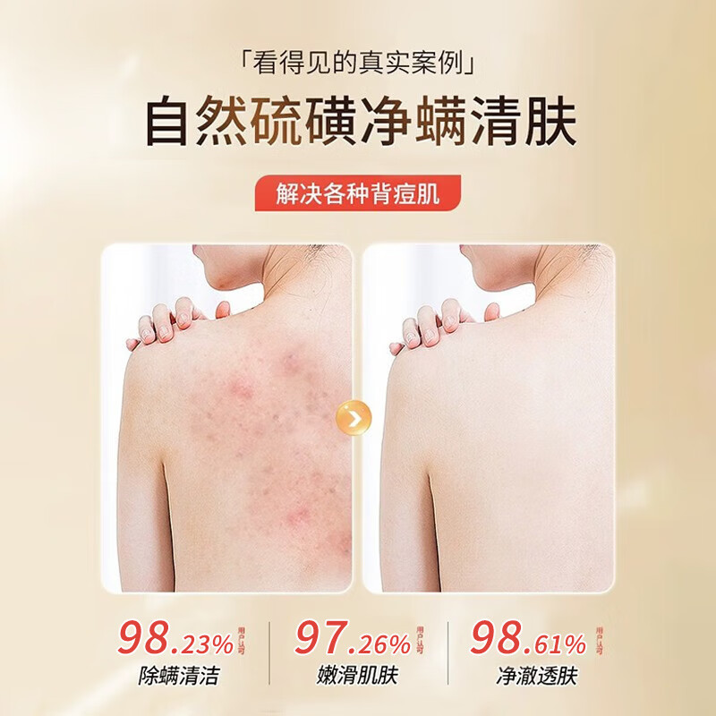 匀美博士硫磺除螨液体沐浴露清洁控油止痒保湿祛螨虫后背痘瘙痒男女通用 硫磺净螨液320mlx2瓶