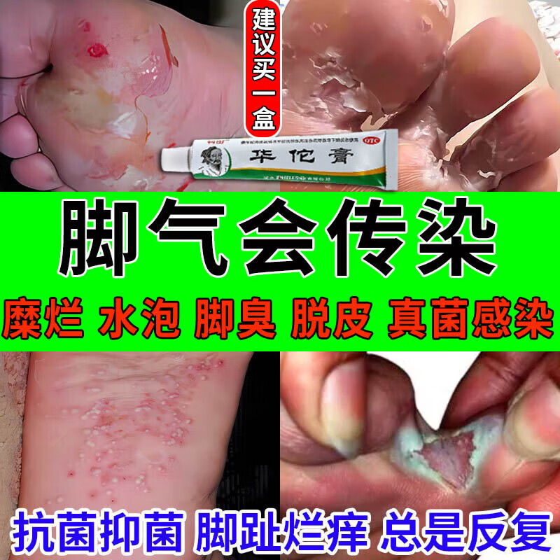 科田华佗膏 脚气水泡型脚气药香港脚臭脚 成人脚气药止痒脱皮烂脚丫