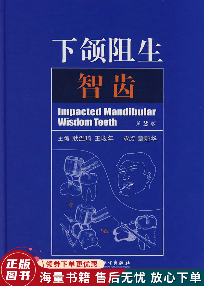 下颌阻生智齿第2版