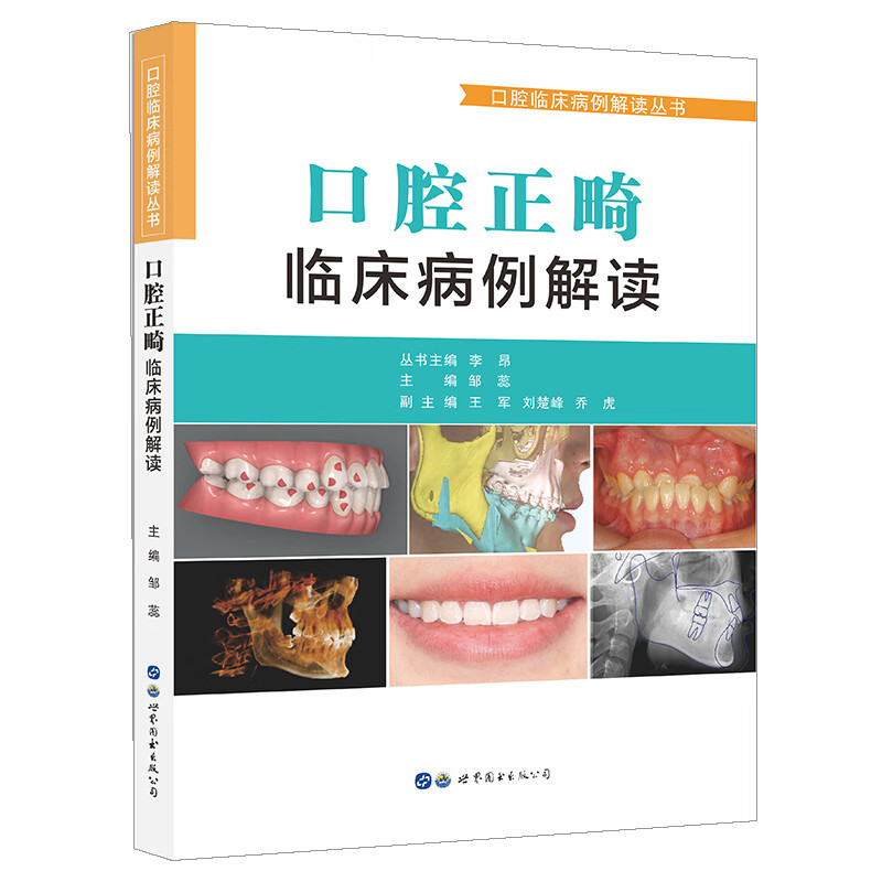 口腔正畸临床病例解读