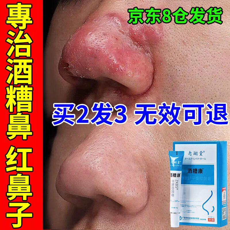 老湖堂酒糟鼻红鼻子草莓鼻红鼻头红血丝酒渣鼻螨虫粉刺黑头皮肤抑菌