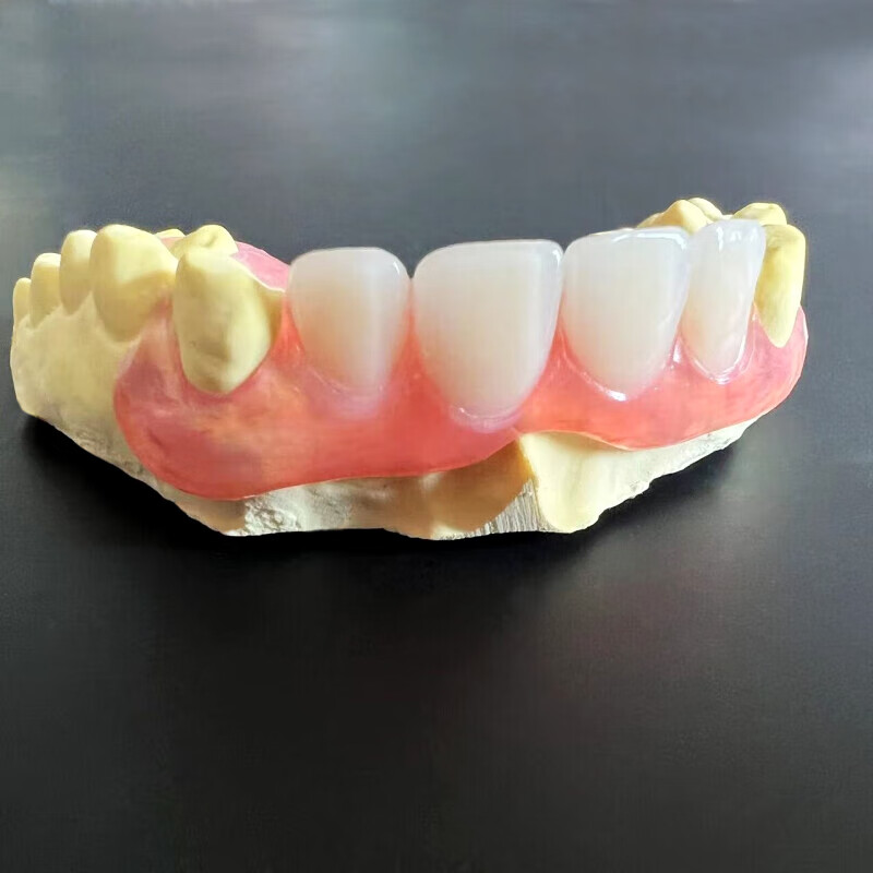 伢益添牙科同款定制隐形义齿门牙假牙定制遮丑隐形假牙假牙齿仿真临时牙 【推荐】超硬塑钢牙【可啃骨头】 缺几颗咨询下单【送取模材料】
