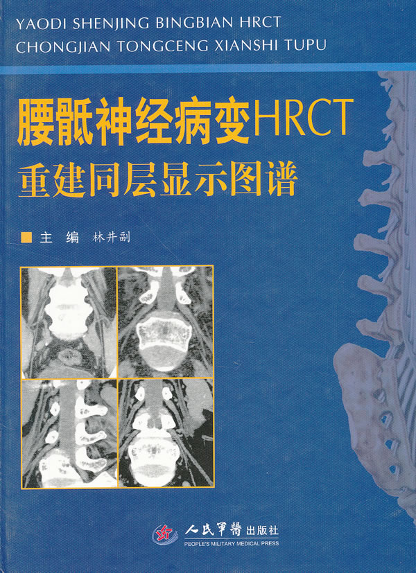 腰骶HRCT重建同层显示图谱【正版图书】