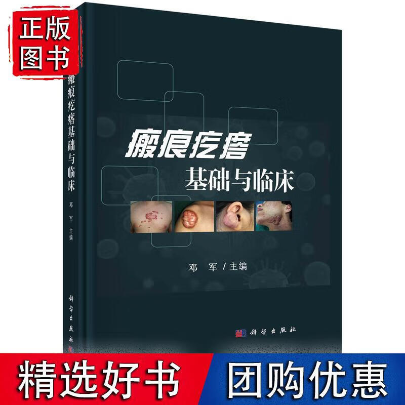 瘢痕疙瘩基础与临床 预计发货10.07