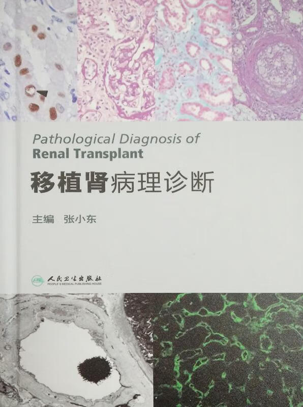 移植肾病理诊断手册 张小东 9787117222297 人民卫生出版社